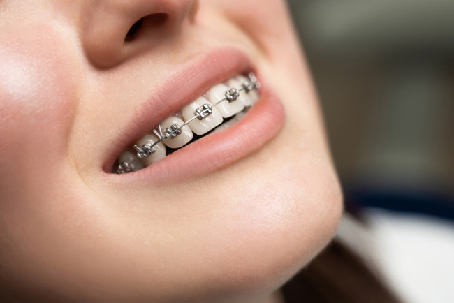 GiO Dental Care Jalan Kaliurang